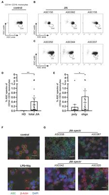 Inflammasome activation and formation of ASC specks in patients with juvenile idiopathic arthritis